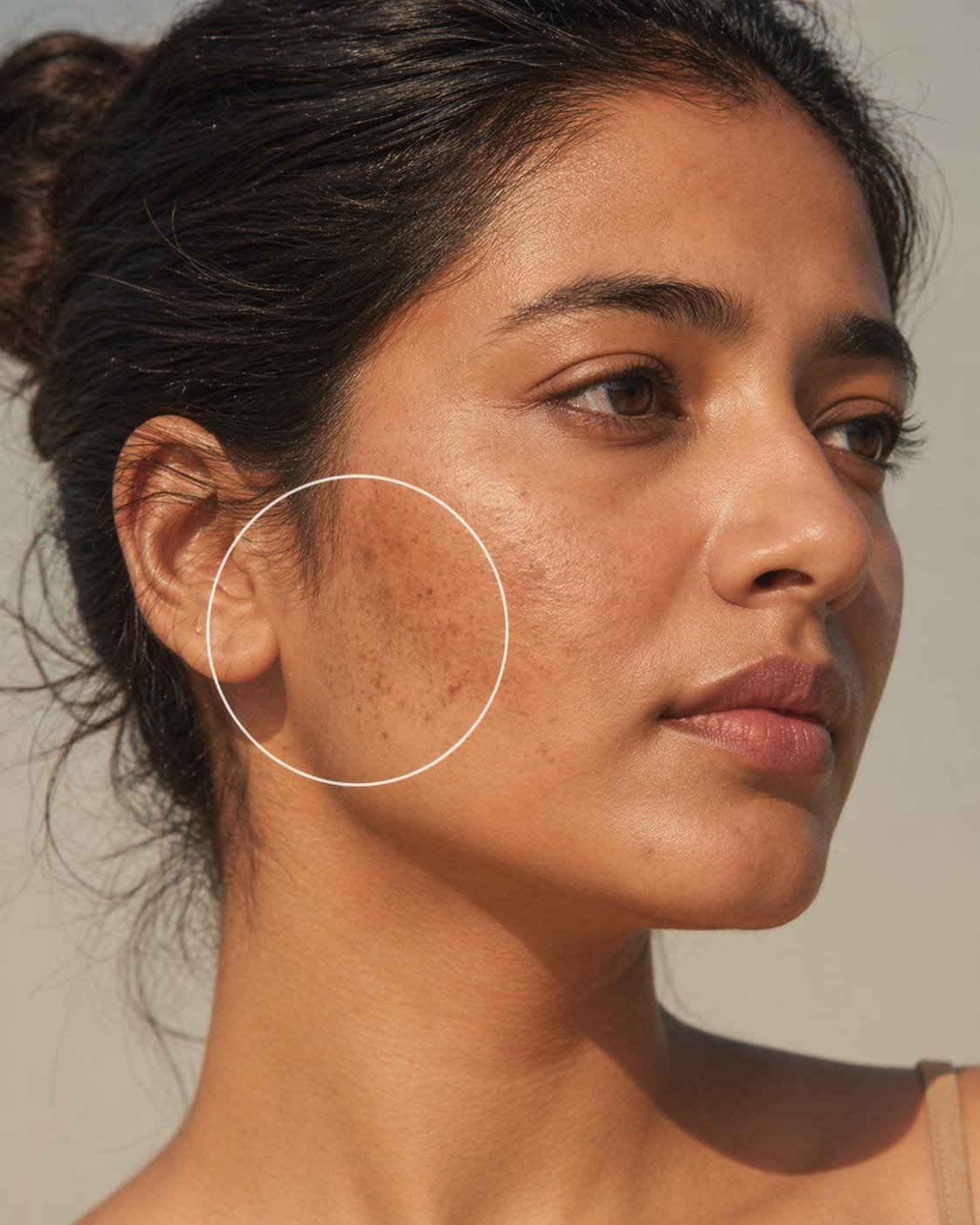 Even Tone & Pigmentation