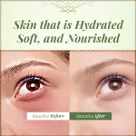 Pure Aloe Vera Gel - 100gm — View 5